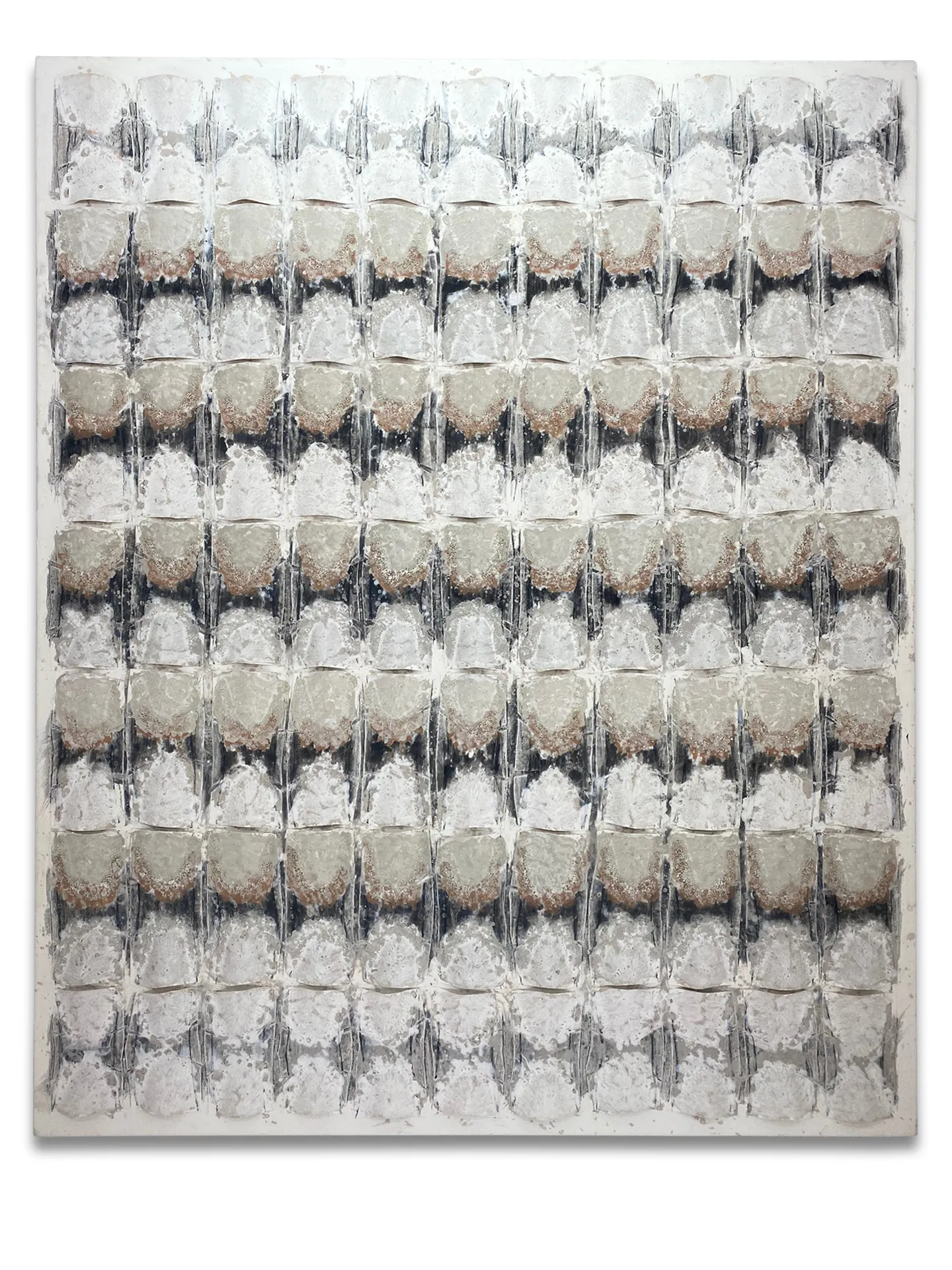 Radiografía de cal frontal